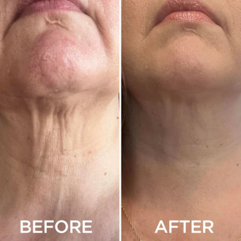 Tight & Lift Neck Cream