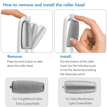 Electric Foot Callus Remover