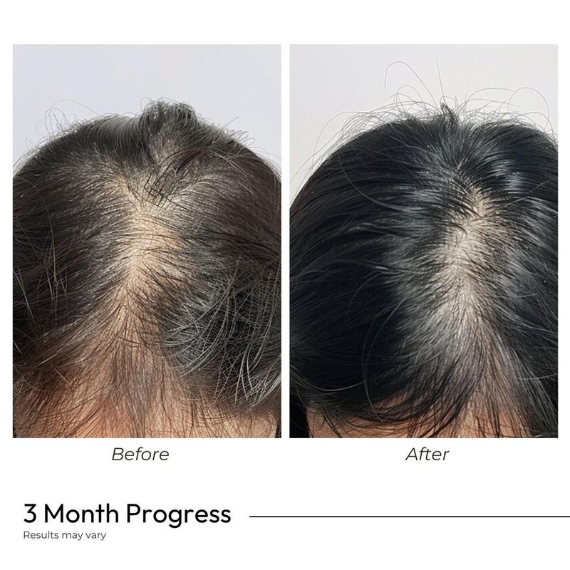 Vegan Gluten Free Haircare Supplement