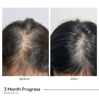Vegan Gluten Free Haircare Supplement